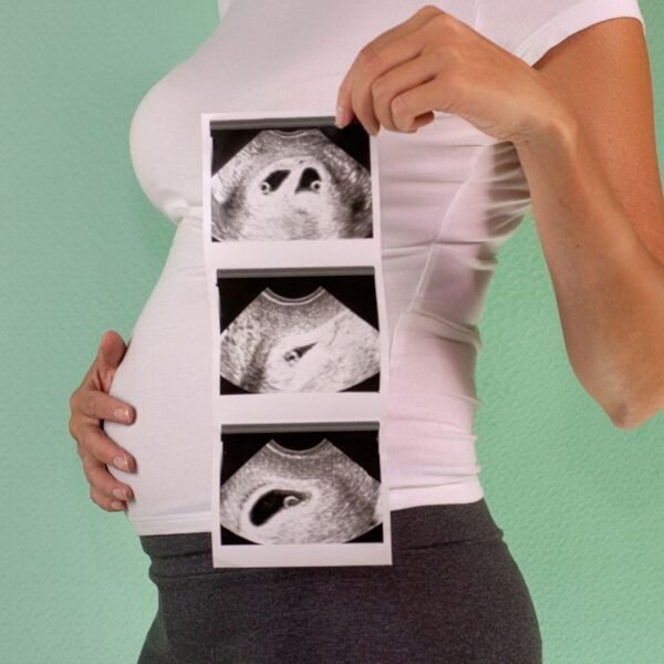 First trimester Ultrasound (6-13 weeks)