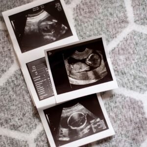 First trimester Nuchal Translucency Ultrasound (11-13 weeks)