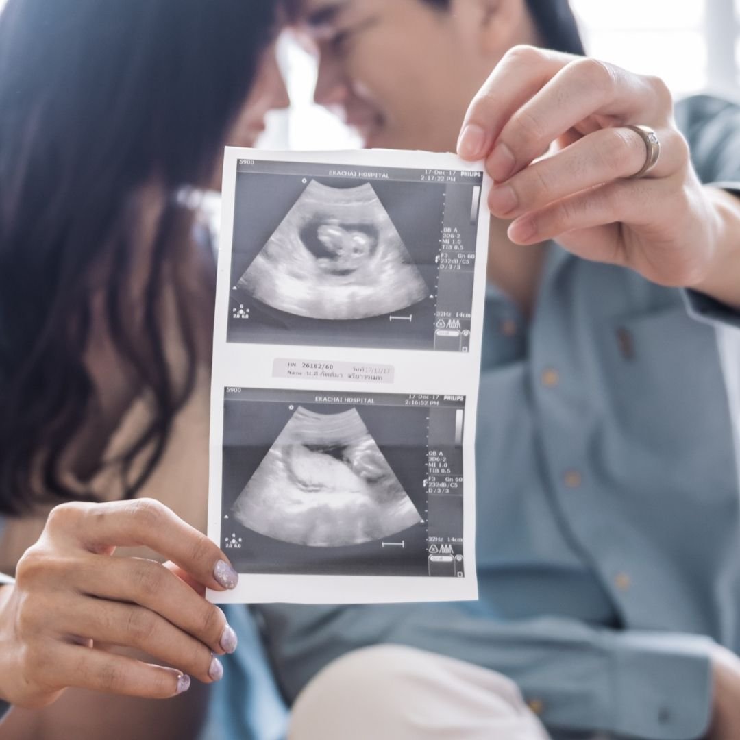 Privilege package (6-42 WEEKS)