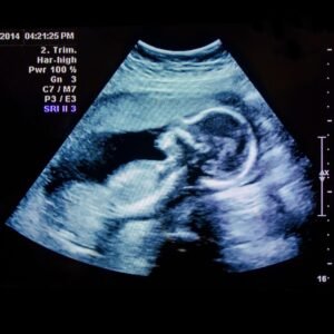 Biophysical scoring (28-42 WEEKS)