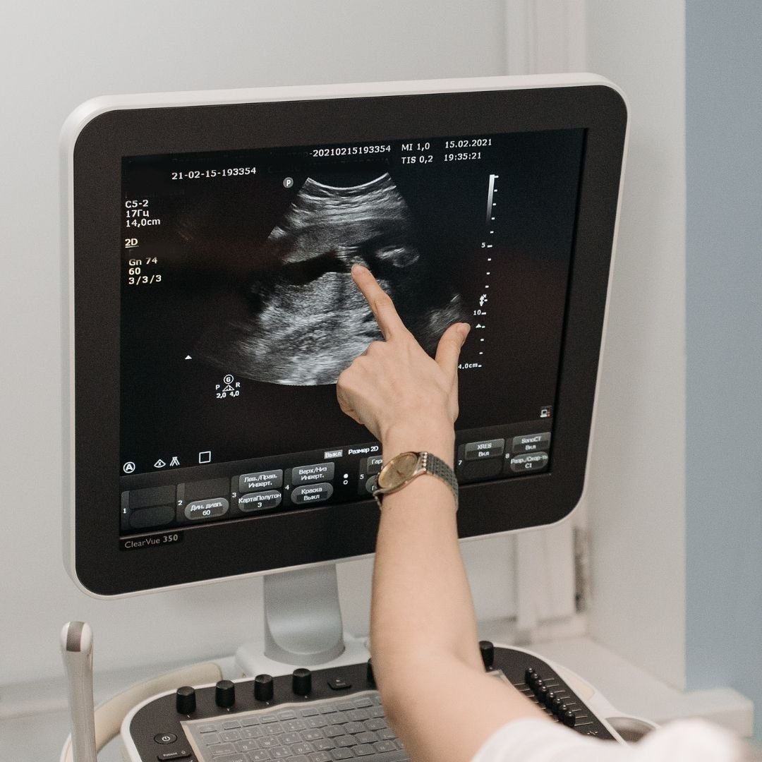 Transrectal ultrasound