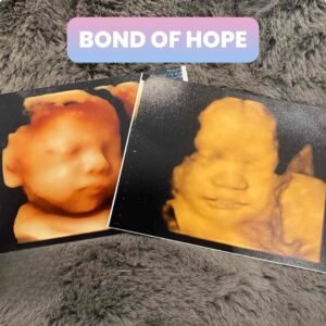 3D / HD Package (22-32 weeks) BOND OF HOPE