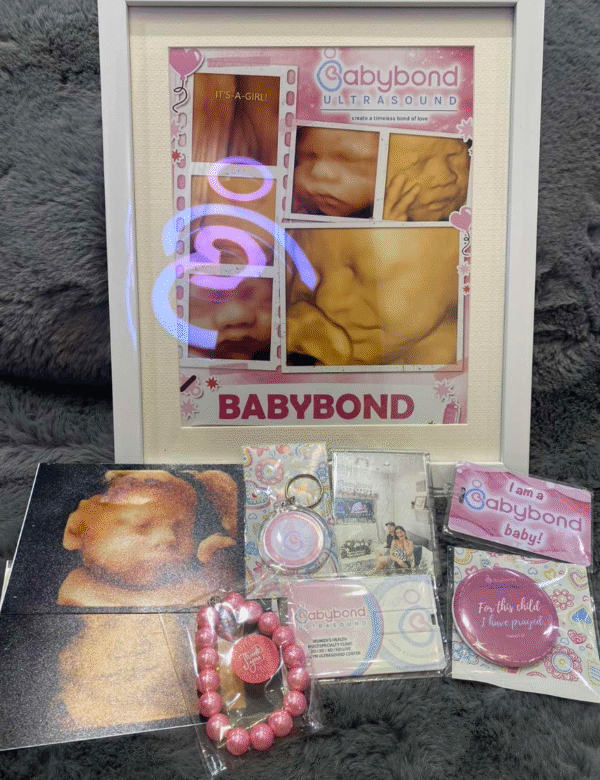 3D / 4D / HD Package (22-32 weeks) BOND OF LOVE - Image 2