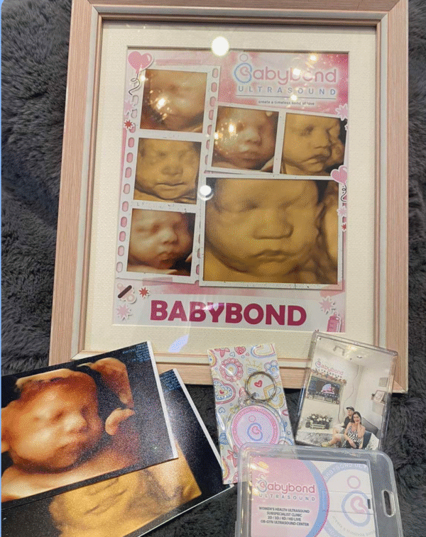 3D / HD Package (22-32 weeks) BOND OF JOY PREMIUM - Image 2
