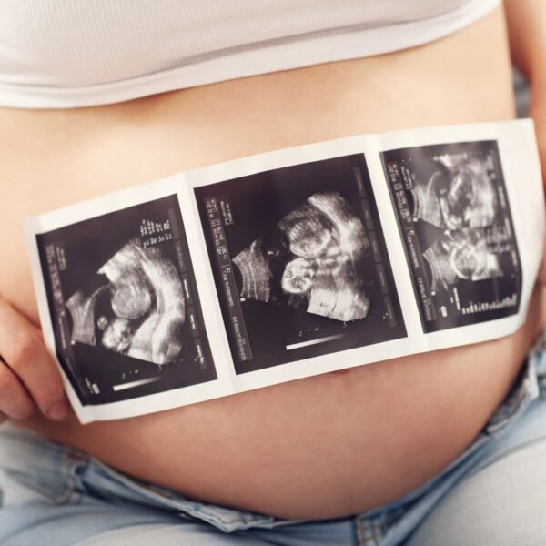 Congenital Anomaly Scan