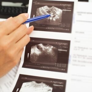 Follicle monitoring