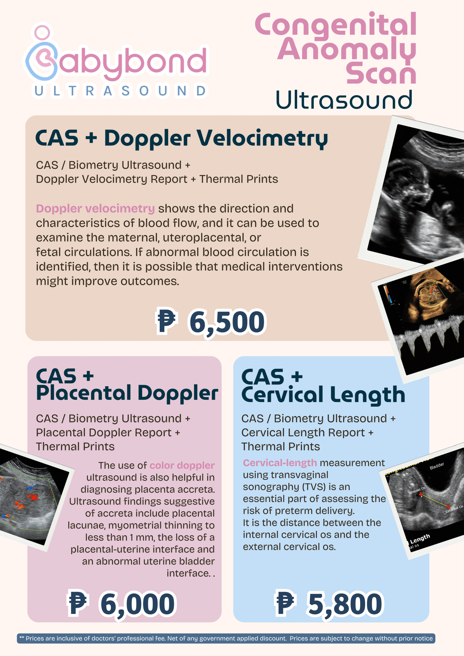 Congenital Anomaly Scan (CAS) + Placental Doppler