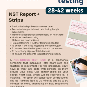 Non Stress Testing (NST)